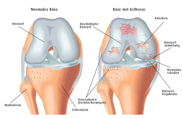 Arthrose Hund
